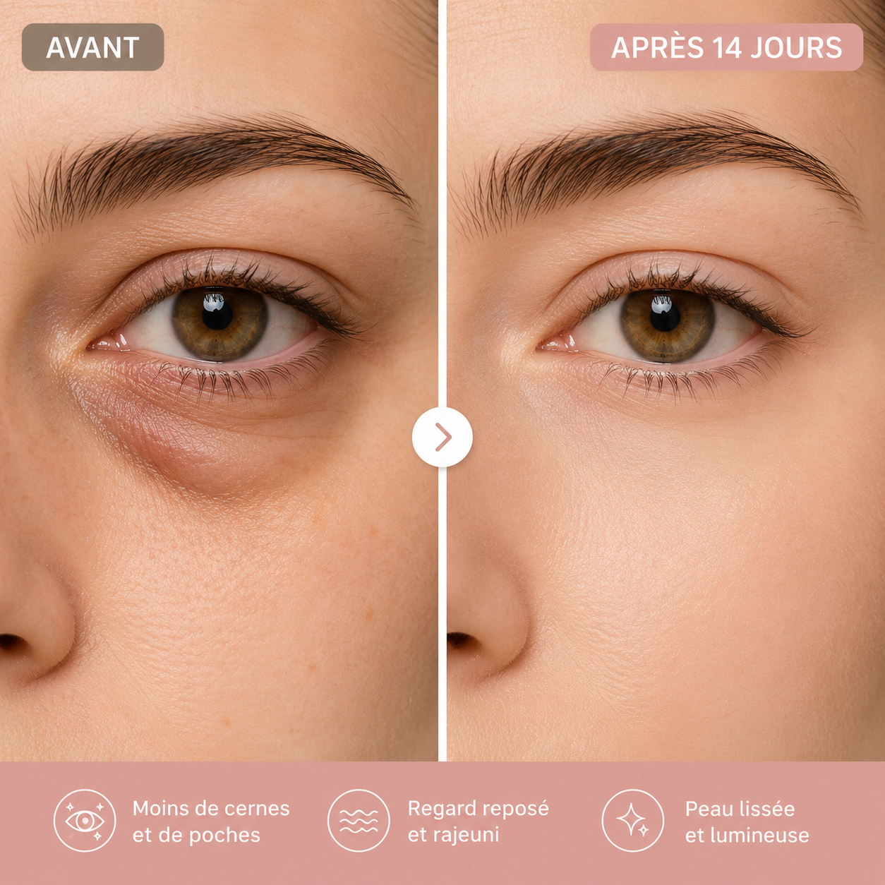 Luméa™ | Patchs Yeux au Collagène — Anti-Cernes & Anti-Poches